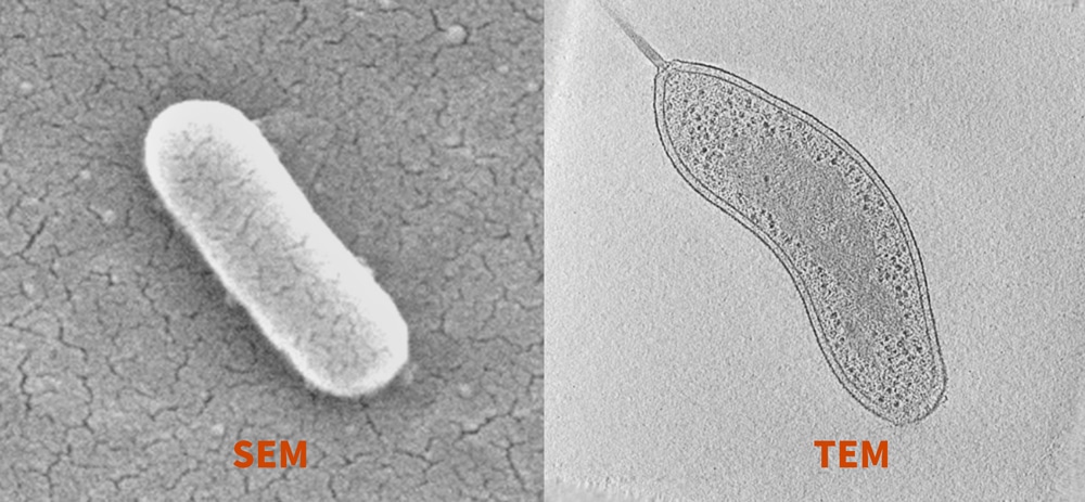 II - La microscopie électronique en transmission